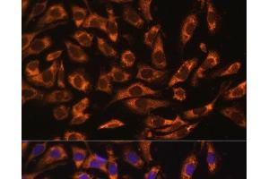 Immunofluorescence analysis of U-2 OS cells using ERK1 / ERK2 Polyclonal Antibody at dilution of 1:100 (40x lens). (ERK1/2 anticorps)