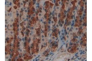 Detection of LIFR in Rat Stomach Tissue using Polyclonal Antibody to Leukemia Inhibitory Factor Receptor (LIFR)