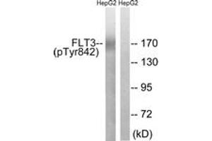 Western blot analysis of extracts from HepG2 cells treated with EGF 200ng/ml 30', using FLT3 (Phospho-Tyr842) Antibody. (FLT3 anticorps  (pTyr842))
