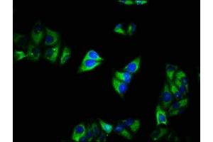 Immunofluorescence staining of Hela cells with ABIN7175577 at 1:200, counter-stained with DAPI. (CACNA2D1 anticorps  (AA 577-717))