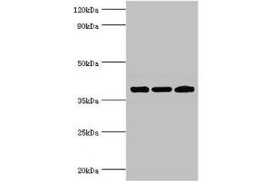 Western blot All lanes: Twinfilin-2 antibody at 3 μg/mL Lane 1: Jurkat whole cell lysate Lane 2: HepG2 whole cell lysate Lane 3: A431 whole cell lysate Secondary Goat polyclonal to rabbit IgG at 1/10000 dilution Predicted band size: 40 kDa Observed band size: 40 kDa (TWF2 anticorps  (AA 1-349))