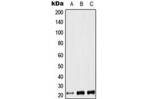 Western blot analysis of LIF expression in Jurkat (A), NIH3T3 (B), PC12 (C) whole cell lysates. (LIF anticorps  (Center))