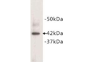 Western blot analysis of mouse heart tissue lysate, using alpha Actin (Cardiac actin) antibody. (ACTC1 anticorps  (N-Term))
