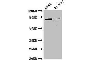 Western Blot Positive WB detected in: Mouse lung tissue, Mouse kidney tissue All lanes: CDH5 antibody at 3 μg/mL Secondary Goat polyclonal to rabbit IgG at 1/50000 dilution Predicted band size: 88, 75 kDa Observed band size: 88 kDa (Cadherin 5 anticorps  (AA 349-569))