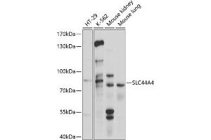 Western blot analysis of extracts of various cell lines, using SLC44 antibody (ABIN6130964, ABIN6148004, ABIN6148005 and ABIN6214687) at 1:1000 dilution. (SLC44A4 anticorps  (AA 65-215))