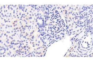 Detection of ATP2A2 in Human Kidney Tissue using Polyclonal Antibody to ATPase, Ca++ Transporting, Cardiac Muscle, Slow Twitch 2 (ATP2A2)