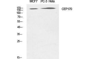 Western Blotting (WB) image for anti-Centrosomal Protein 170kDa (CEP170) (Internal Region) antibody (ABIN3174342) (CEP170 anticorps  (Internal Region))