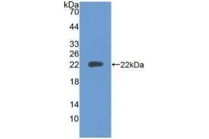 Detection of Recombinant PTPRN, Human using Polyclonal Antibody to Protein Tyrosine Phosphatase Receptor Type N (PTPRN)