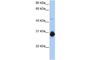 WB Suggested Anti-RHOU Antibody Titration:  0. (RHOU anticorps  (C-Term))