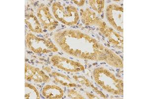 Immunohistochemistry of paraffin-embedded human kidney using CDC42 antibody at dilution of 1:200 (x400 lens) (CDC42 anticorps)