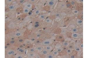 Detection of AT in Human Liver Tissue using Monoclonal Antibody to Antithrombin (AT)