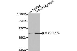 Western blot analysis of extracts from A431 cells using Phospho-MYC-S373 antibody (ABIN2987392). (c-MYC anticorps  (pSer373))