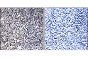 Immunohistochemistry analysis of paraffin-embedded human tonsil tissue, using MRPS16 Antibody.