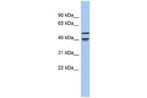 WB Suggested Anti-APOBEC4 Antibody Titration: 0.