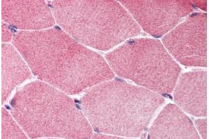 Human Skeletal Muscle (formalin-fixed, paraffin-embedded) stained with TSC1 antibody ABIN214014 at 5 ug/ml followed by biotinylated goat anti-rabbit IgG secondary antibody ABIN481713, alkaline phosphatase-streptavidin and chromogen. (TSC1 anticorps  (C-Term))
