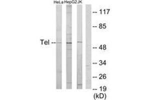 Western blot analysis of extracts from HeLa/HepG2/Jurkat cells, using ETV6 Antibody. (ETV6 anticorps  (AA 371-420))