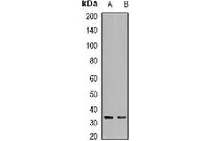 Western blot analysis of DCK expression in Raji (A), HepG2 (B) whole cell lysates. (DCK anticorps)