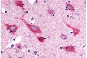Anti-GPR126 antibody  ABIN1048707 IHC staining of human brain, neurons and glia.
