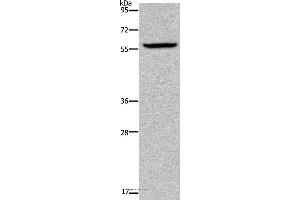 Western blot analysis of Human fetal brain tissue, using KDM4D Polyclonal Antibody at dilution of 1:1100 (JMJD2D anticorps)