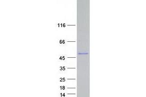 Validation with Western Blot
