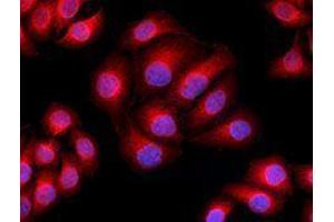 Immunofluorescence (IF) image for anti-alpha Tubulin (TUBA1) antibody (Alexa Fluor 594) (ABIN2656867)