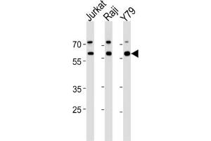 Western Blotting (WB) image for anti-Acetylcholinesterase (AChE) antibody (ABIN3003530) (Acetylcholinesterase anticorps)
