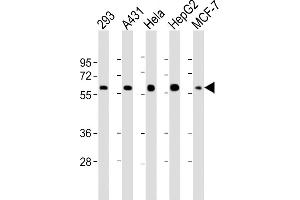 All lanes : Anti-p53 Antibody  at 1:2000 dilution Lane 1: 293 whole cell lysate Lane 2: A431 whole cell lysate Lane 3: Hela whole cell lysate Lane 4: HepG2 whole cell lysate Lane 5: MCF-7 whole cell lysate Lysates/proteins at 20 μg per lane.
