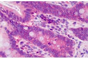 Human Small Intestine: Formalin-Fixed, Paraffin-Embedded (FFPE) (POLDIP3 anticorps  (AA 326-375))