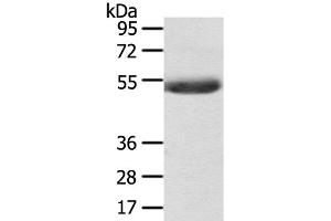 Western Blot analysis of Mouse plasma tissue using AGPAT6 Polyclonal Antibody at dilution of 1:400