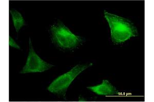 Immunofluorescence of monoclonal antibody to PRRG1 on HeLa cell. (PRRG1 anticorps  (AA 22-81))