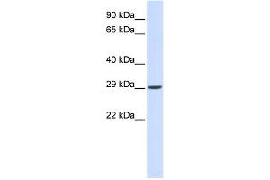 WB Suggested Anti-VTI1A Antibody Titration: 0. (VTI1A anticorps  (N-Term))