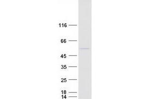 Validation with Western Blot