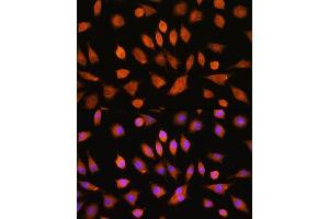 Immunofluorescence analysis of L929 cells using PI4KA Rabbit pAb (ABIN7269286) at dilution of 1:100. (PI4KA anticorps)