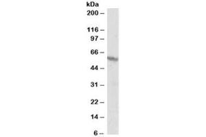 Western blot testing of A431 lysate and RXR beta antibody at 1ug/ml. (Retinoid X Receptor beta anticorps)