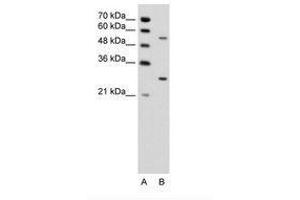 Image no. 1 for anti-3-phosphoinositide Dependent Protein Kinase-1 (PDPK1) (AA 201-250) antibody (ABIN6736342) (PDPK1 anticorps  (AA 201-250))