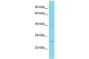 Host: Rabbit Target Name: PPP1R35 Sample Type: Jurkat Whole Cell lysates Antibody Dilution: 1. (PPP1R35 anticorps  (N-Term))