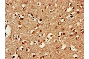 Immunohistochemistry of paraffin-embedded human brain tissue using ABIN7174583 at dilution of 1:100 (USP18 anticorps  (C-Term))