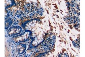 Detection of C5a in Rat Colon Tissue using Monoclonal Antibody to Complement Component 5a (C5a)