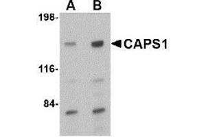 Western blot analysis of CAPS1 in rat brain tissue lysate with AP30178PU-N CAPS1 antibody at (A) 0.