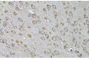 Immunohistochemistry of paraffin-embedded Mouse brain using Snail Polyclonal Antibody at dilution of 1:100 (40x lens). (SNAIL anticorps)