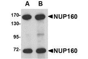 Image no. 1 for anti-Nucleoporin 160kDa (NUP160) (C-Term) antibody (ABIN1103361) (NUP160 anticorps  (C-Term))