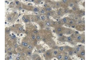 Detection of MYH14 in Human Liver Tissue using Polyclonal Antibody to Myosin Heavy Chain 14, Non Muscle (MYH14) (Myosin anticorps  (AA 1069-1331))