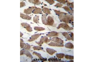 ACTN3 Antibody (Center) immunohistochemistry analysis in formalin fixed and paraffin embedded human skeletal muscle followed by peroxidase conjugation of the secondary antibody and DAB staining. (ACTN3 anticorps  (Middle Region))