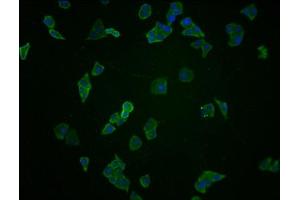 Immunofluorescence staining of Hela cells with ABIN7145214 at 1:100, counter-stained with DAPI. (BAG3 anticorps  (AA 220-420))