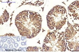 Immunohistochemical analysis of paraffin-embedded mouse testis tissue. (MICU1 anticorps)