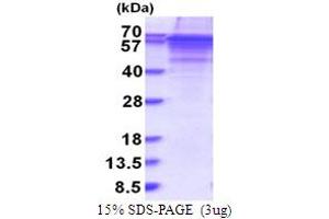 SDS-PAGE (SDS) image for Vitronectin (VTN) (AA 20-478) protein (His tag) (ABIN5853784)