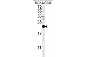 Western blot analysis of IL1F6 Antibody (Center) (ABIN651427 and ABIN2840233) in MDA-M cell line lysates (35 μg/lane). (IL36A/IL1F6 anticorps  (AA 35-61))
