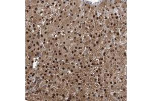 Immunohistochemical staining of human liver with C11orf73 polyclonal antibody  shows strong nuclear and cytoplasmic positivity in hepatocytes at 1:500-1:1000 dilution. (C11orf73 anticorps)