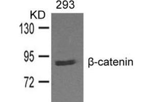 Western blot analysis of extracts from 293 cells and using β-catenin. (CTNNB1 anticorps  (AA 327-331))