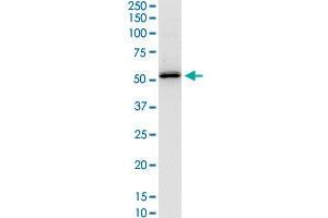 SERPINH1 monoclonal antibody (M01), clone S2.